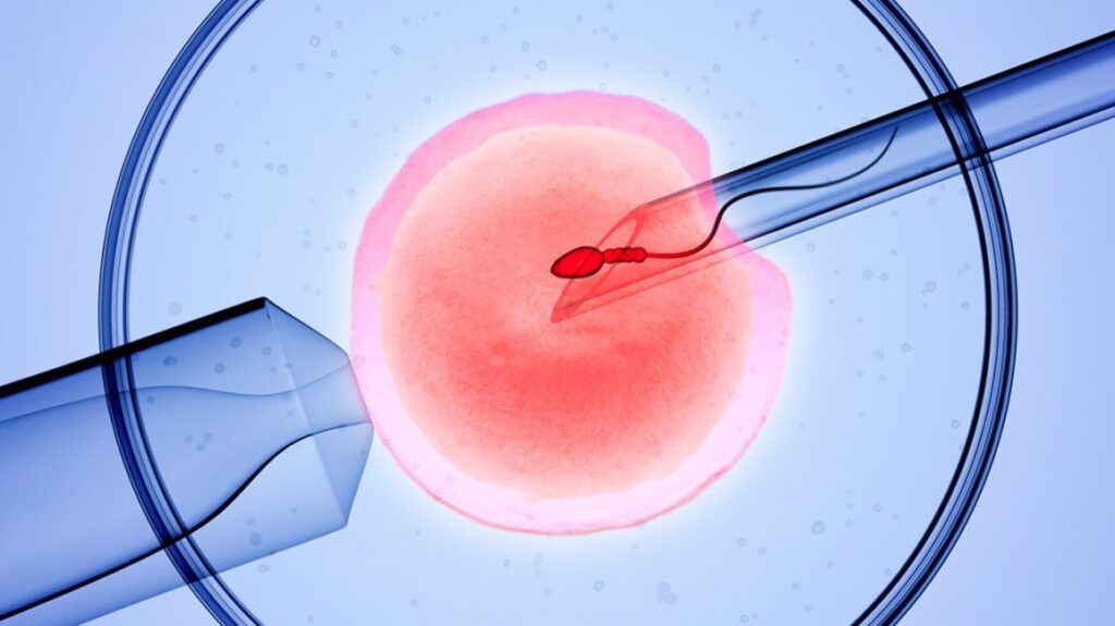 IVF Treatment Cost in Hyderabad