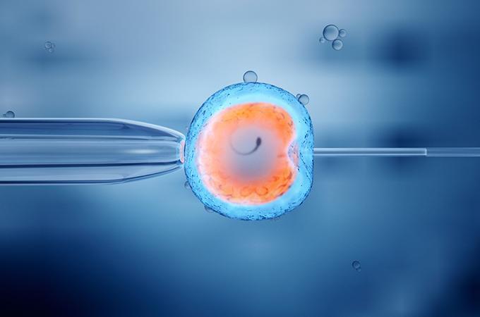 IVF Treatment