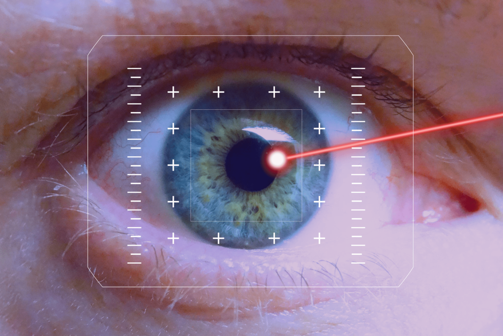 Eye Surgery Cost
