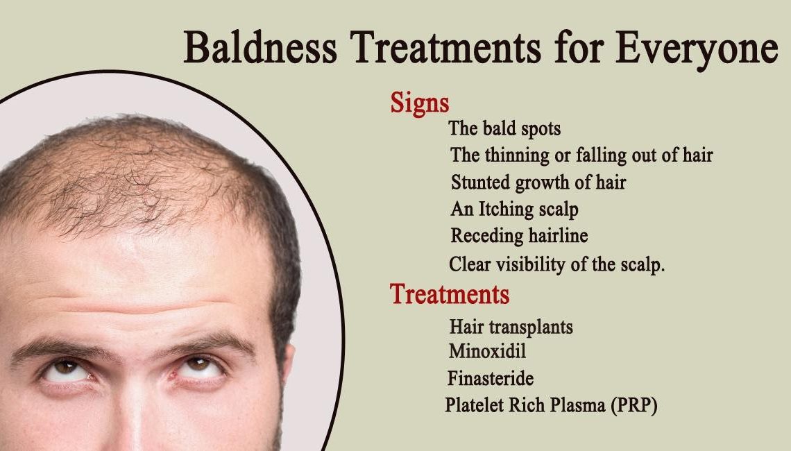 What is Baldness Treatment? Signs, Causes, and Treatments