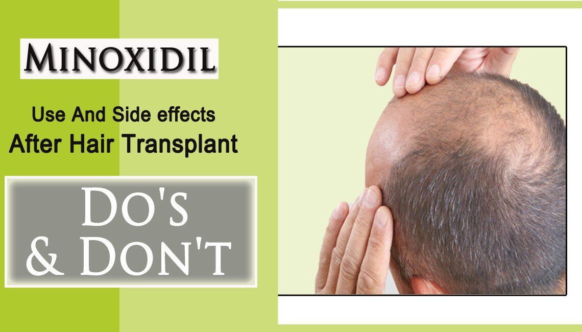 Understanding Minoxidil Unwanted Side Effects