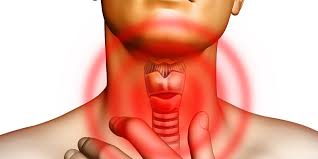 hyperthyroidism