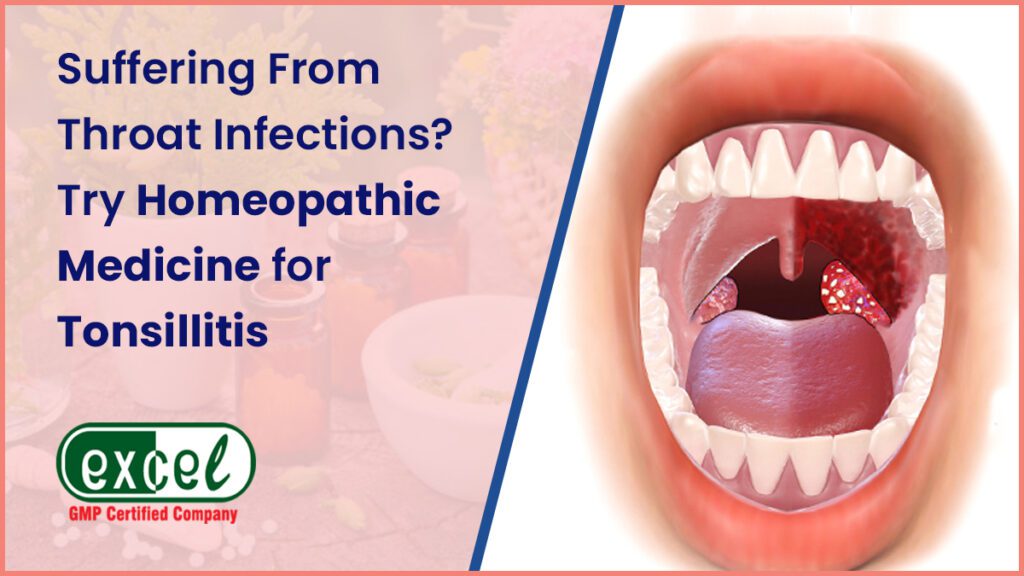 Best Homeopathic Medicine For Tonsillitis